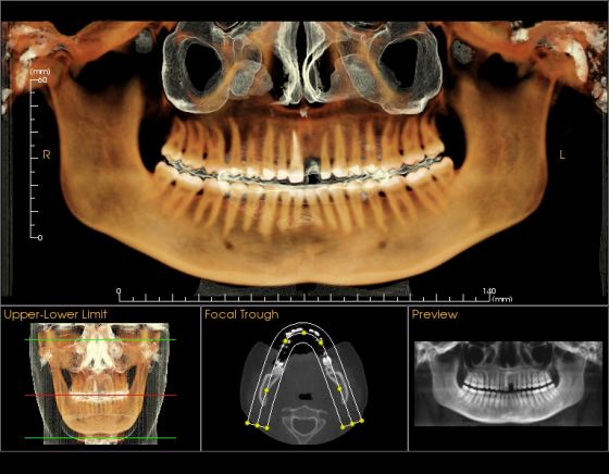 https://www.bestdentistguide.com/wp-content/uploads/2018/12/i-cat-vision-pano-photo.jpg