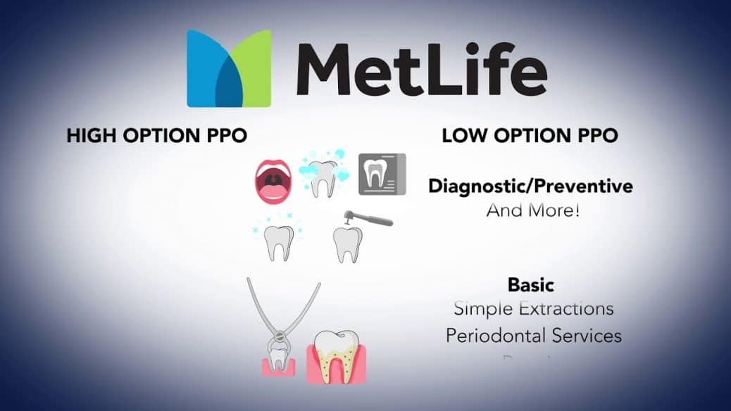 Reviewing Your Choices Regarding MetLife Dental Plans Top Dentist Reviews