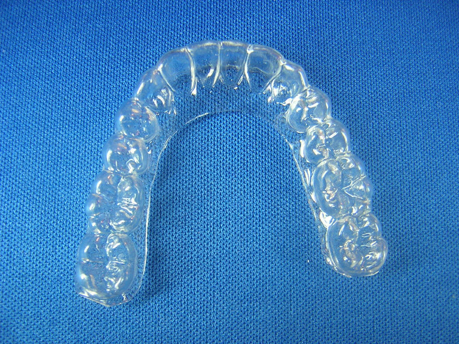 replacement retainers 0 600x450 Keeping Your Teeth Aligned Before Replacement Retainers Arrive