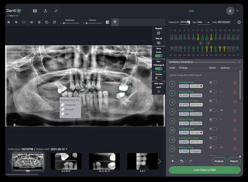 Dental AI