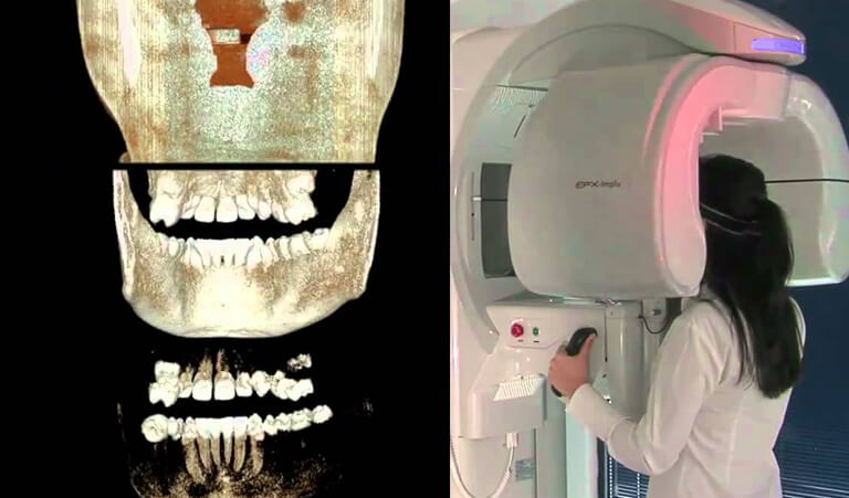  Cone Beam CT and 3D imaging 
