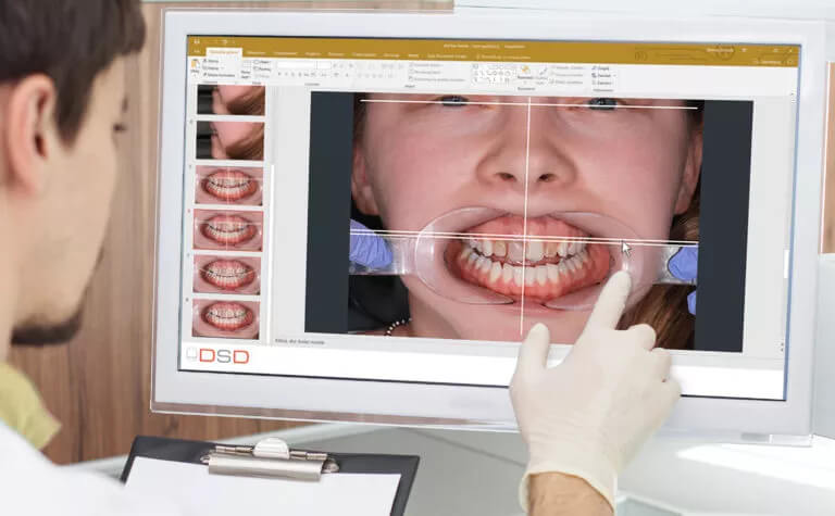 digital smile design 