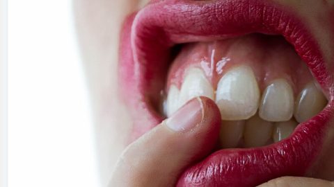 Do Gums Recede with Age