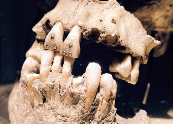 Hesy-Ra: History's First Dentist